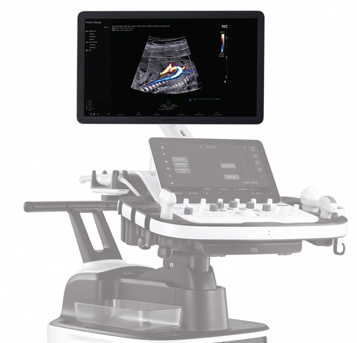 ultrasound-machines-in-the-world