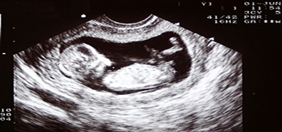 Ultrasounds-during-pregnancy