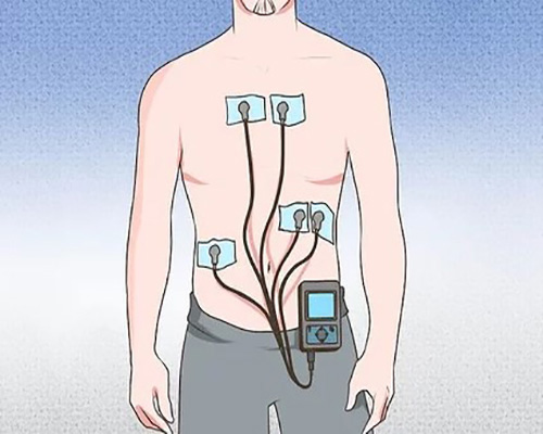 What-is-a-Holter-monitor